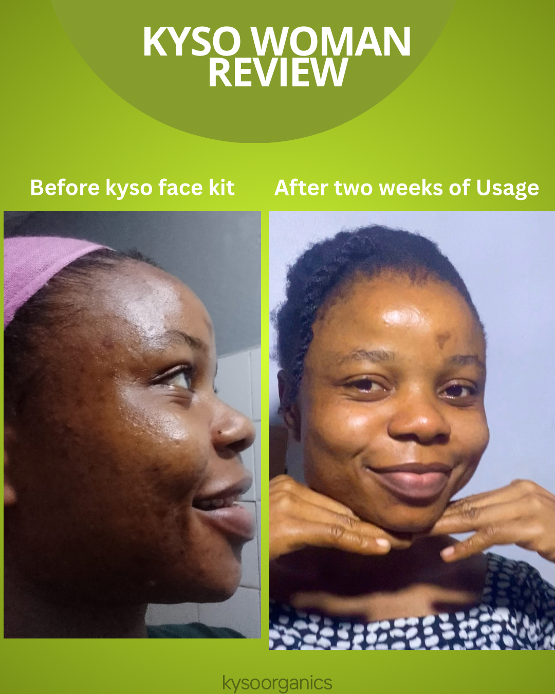 Smooth and glow face combo - Image 3