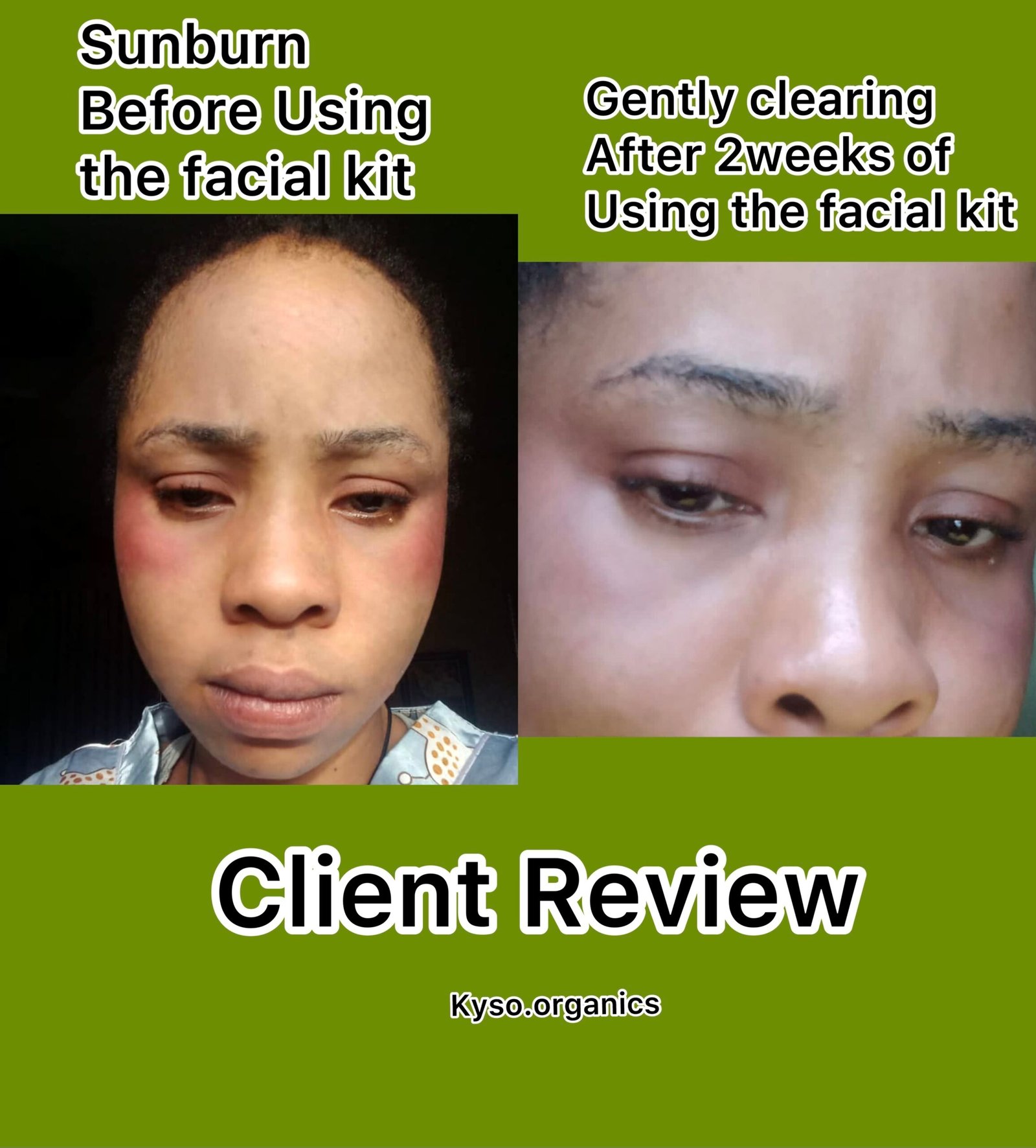 Smooth and glow face combo - Image 6